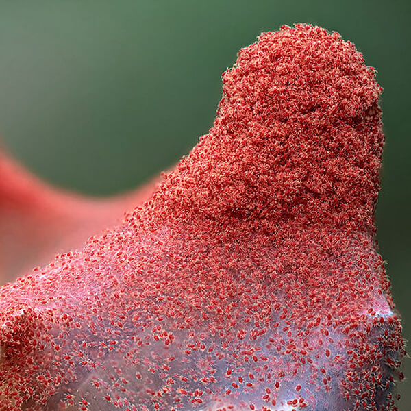 Pest Control McMahon Exterminating Mites